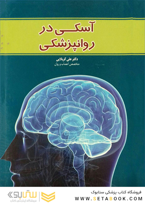 آسکی در روانپزشکی