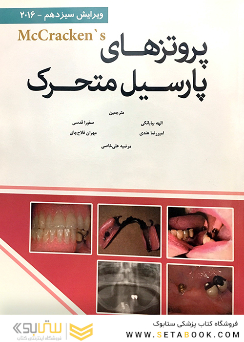 پروتزهای پارسیل متحرک مک کراکن 2016