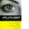 تکنولوژی جراحی چشم