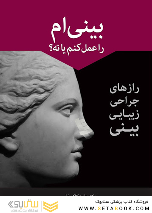 بینی ام را عمل کنم یا نه؟
