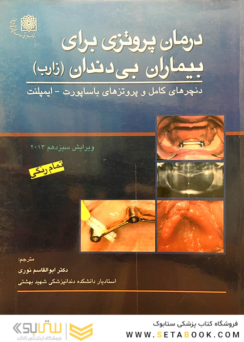 درمان پروتزی برای بیماران بی‌ دندان (زارب) تمام رنگی