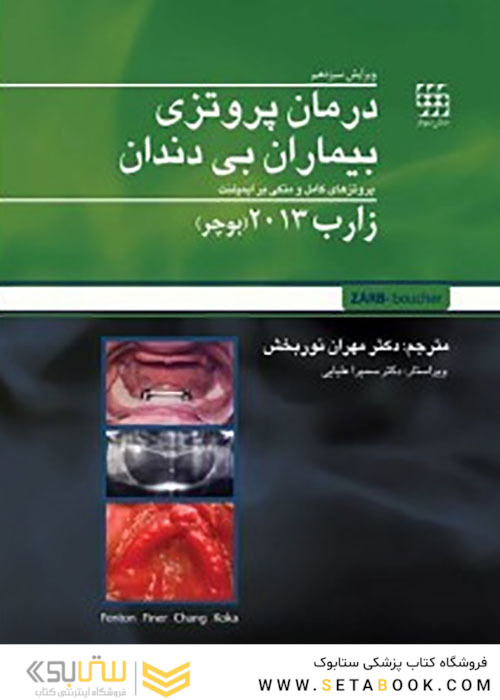درمان پروتزی بیماران بی دندان زارب بوچر 2013