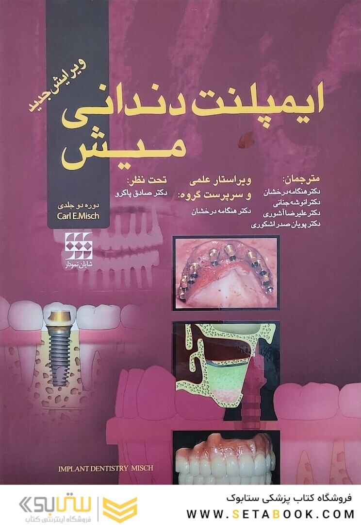 ایمپلنت دندانی میش 1 و 2