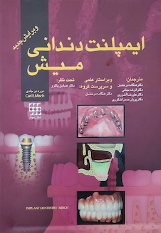 عکس ایمپلنت دندانی میش 1 و 2