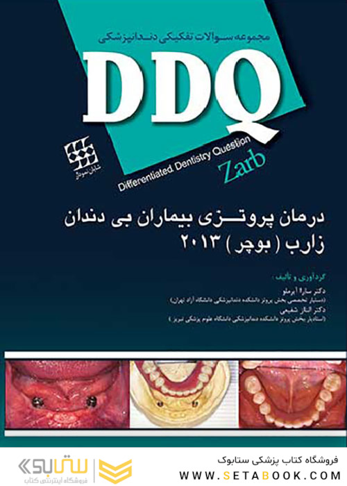 DDQ مجموعه سوالات تفکیکی دندانپزشکی درمان پروتزی بیماران بی دندان زارب بوچر 2013