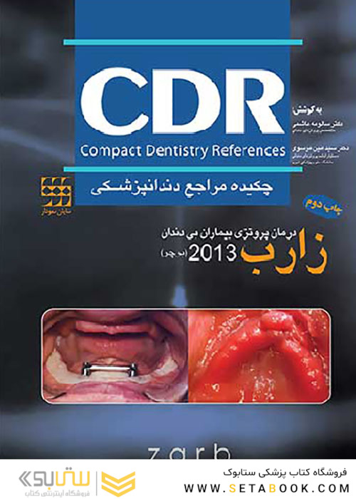 CDR چکیده مراجع دندانپزشکی درمان پروتزی بیماران بی دندان زارب بوچر 2013