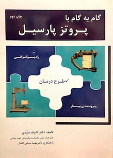 عکس گام به گام با پروتز پارسیل