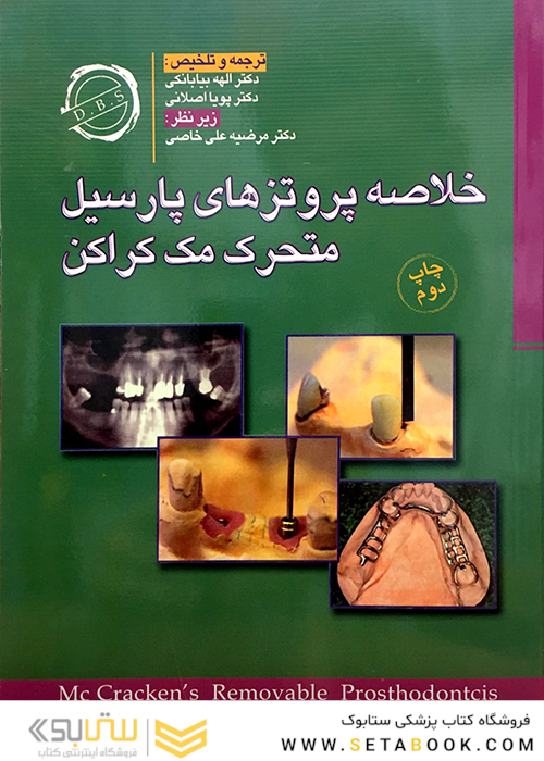 کتاب خلاصه پروتز های پارسیل متحرک مک کراکن