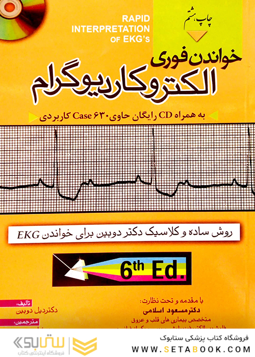 خواندن فوری الکتروکاردیوگرام
