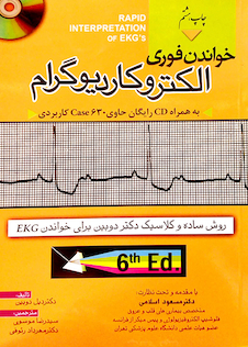 عکس خواندن فوری الکتروکاردیوگرام