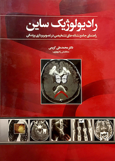 عکس رادیولوژیک ساین