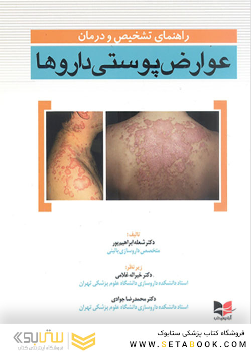 راهنمای تشخیص و درمان عوارض پوستی داروها