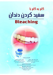عکس گام به گام با سفید کردن دندان Bleaching
