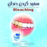 گام به گام با سفید کردن دندان Bleaching