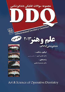 عکس DDQ مجموعه سوالات تفکیکی دندانپزشکی دندانپزشکی ترمیمی علم وهنر 2013