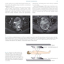 Diagnostic Imaging Armstrong 7th Edicion  2013