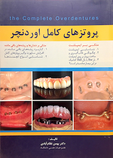 عکس پروتزهای کامل اوردنچر
