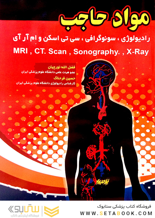 مواد حاجب