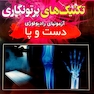 تکنیک های پرتونگاری دست و پا