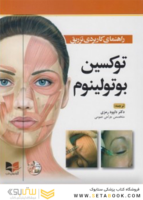 راهنمای کاربردی تزریق توکسین بوتولینوم