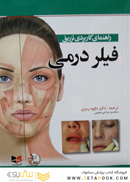 راهنمای کاربردی تزریق فیلر درمی