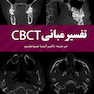 تفسیر مبانی CBCT