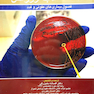 دانشنامه طب اورژانس روزن 2014 عفونی و غدد جلد 5