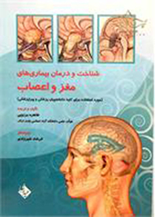 عکس شناخت و درمان بیماری های مغز و اعصاب