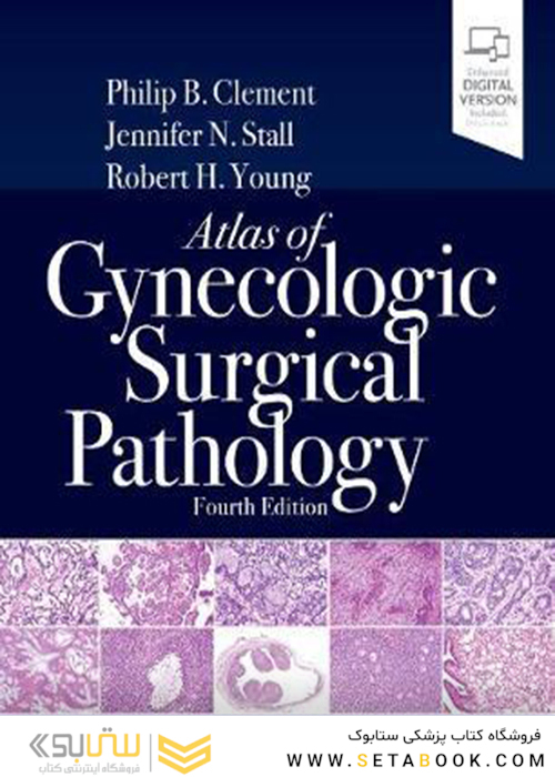 Atlas of Gynecologic Surgical Pathology