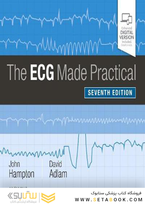 The ECG Made Practical