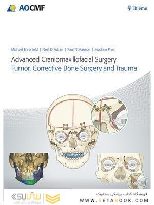 Advanced Craniomaxillofacial Surgery : Tumor, Corrective Bone Surgery, and Trauma 2020