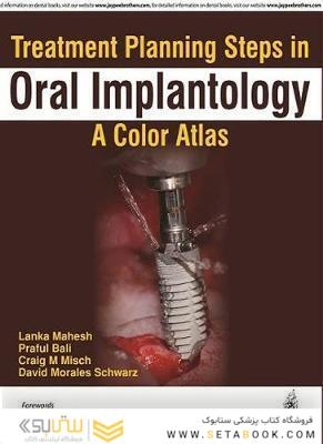 Treatment Planning Steps in Oral Implantology 2018
