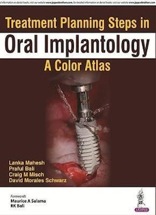 عکس Treatment Planning Steps in Oral Implantology 2018