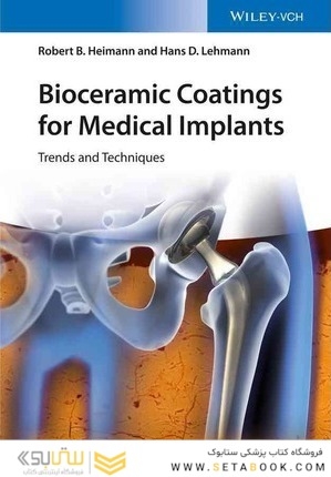 Bioceramic Coatings for Medical Implants 2015