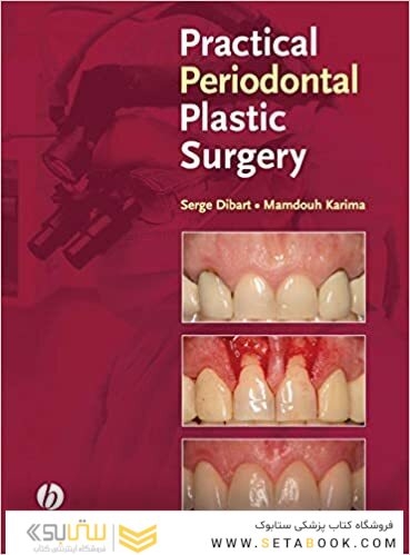 Practical Periodontal Plastic Surgery 1st Edition