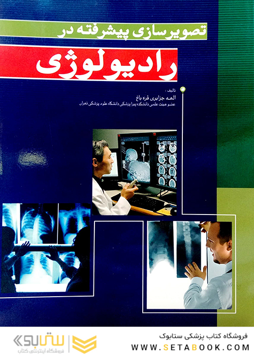 تصویرسازی پیشرفته در رادیولوژی