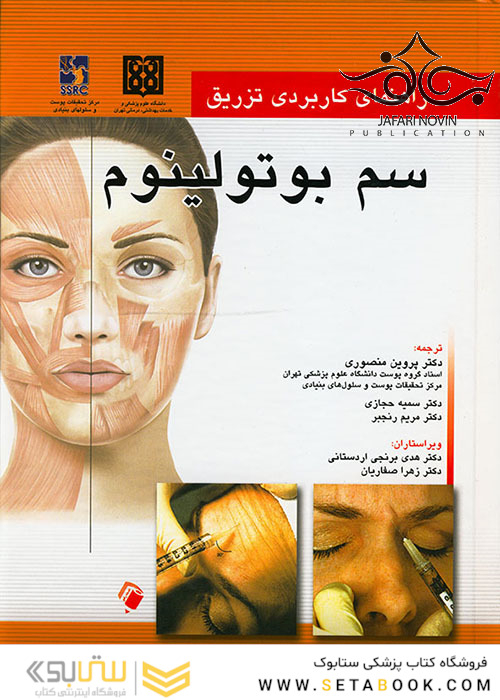 راهنمای کاربردی تزریق سم بوتولینوم
