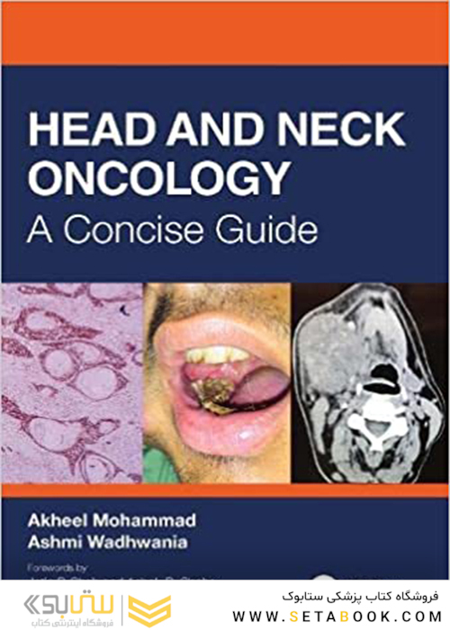 Head and Neck Oncology: A Concise Guide 1st Edición