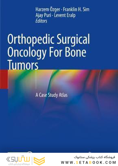 Orthopedic Surgical Oncology For Bone Tumors