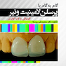 گام به گام با پرسلن لامینیت ونیر