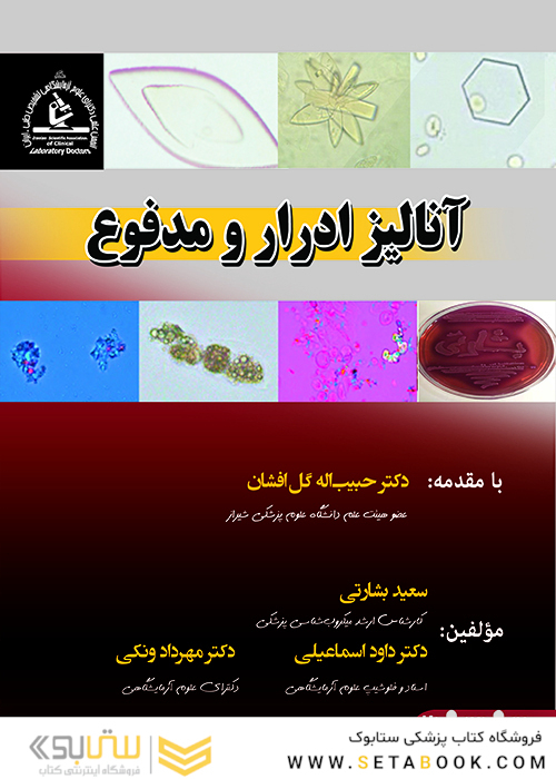 آنالیز ادرار و مدفوع