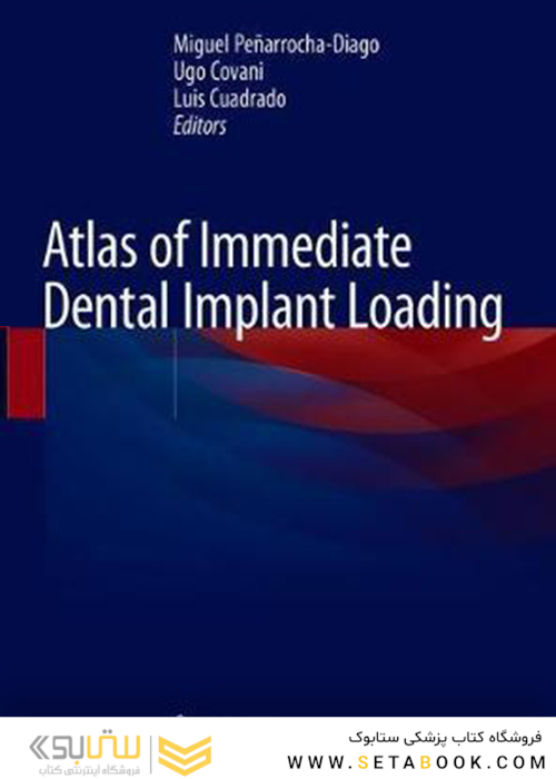 Atlas of Immediate Dental Implant Loading 1st ed. 2019 Edition اطلس ایمپلنت دندان فوری