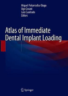 عکس Atlas of Immediate Dental Implant Loading 1st ed. 2019 Edition