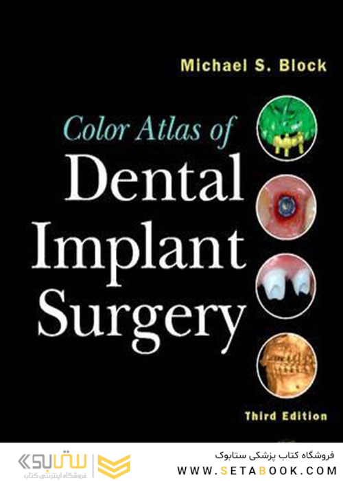 Color Atlas of Dental Implant Surgery
