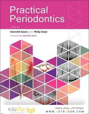 Practical Periodontics