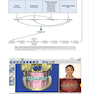 Principles and Biomechanics of Aligner Treatment