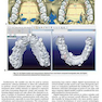 Principles and Biomechanics of Aligner Treatment