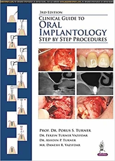عکس Clinical Guide to Oral Implantology: Step by Step Procedures 3rd Edition