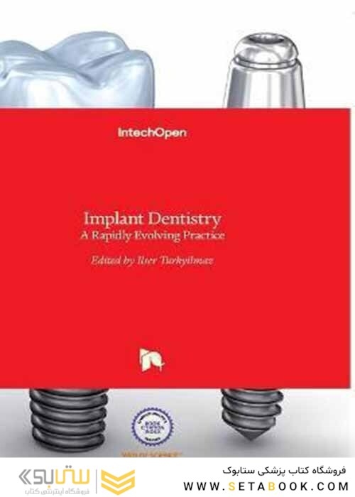 Implant Dentistry : A Rapidly Evolving Practice