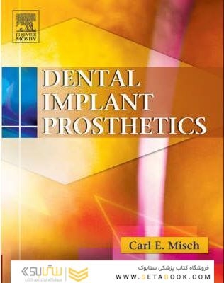 Dental Implant Prosthetics